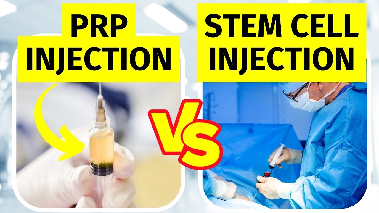 PRP Injection vs Stem Cell Therapy for Knee Arthritis