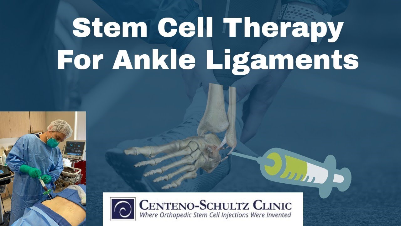 Stem Cell Therapy For Ankle Ligaments