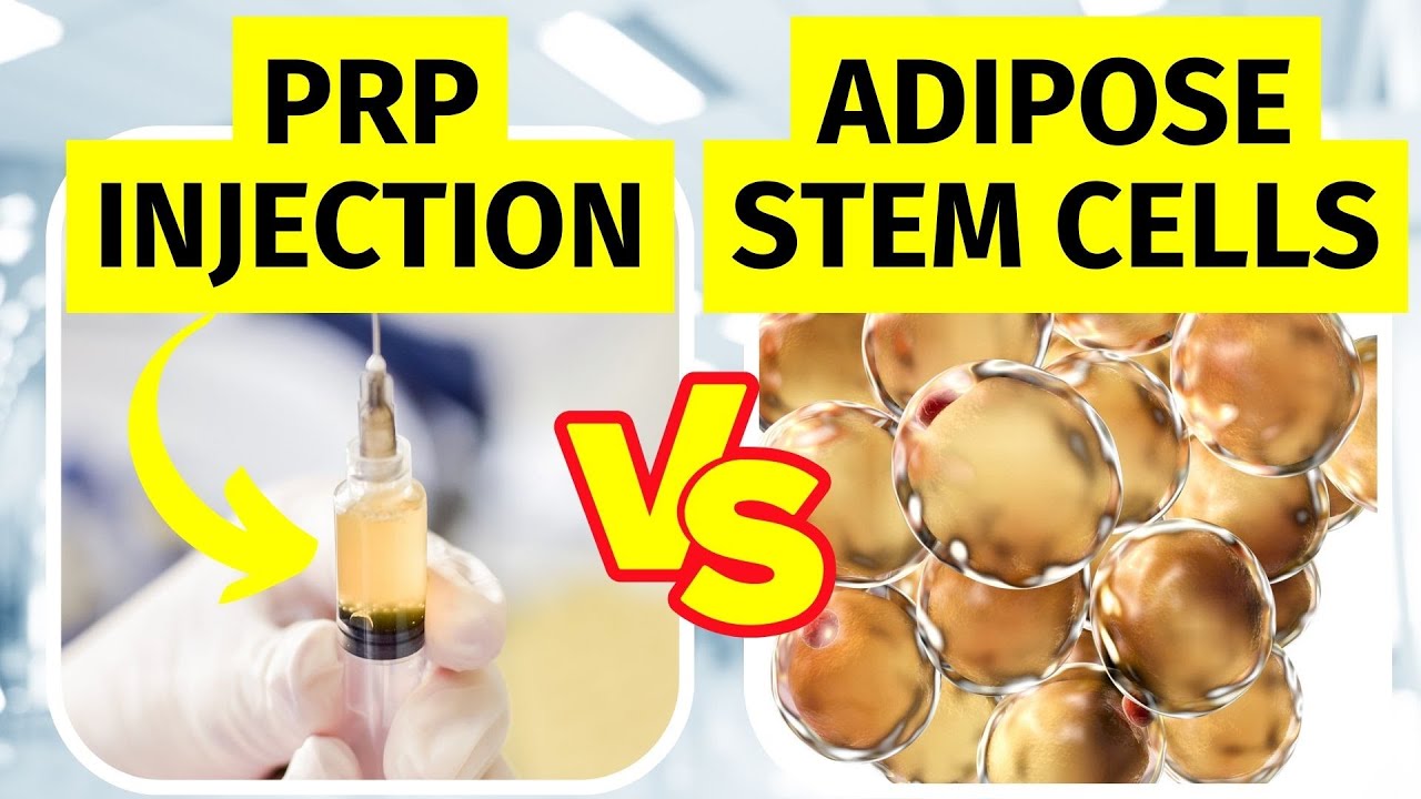 Prp Injection Vs Adipose Stem Cell Therapy For Knee Arthritis Stem